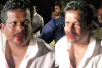 ரத்தம் சொட்ட தாக்கிக் கொண்ட நிர்வாகிகள் - ரணகளமான காங்கிரஸ் அலுவலகம்!