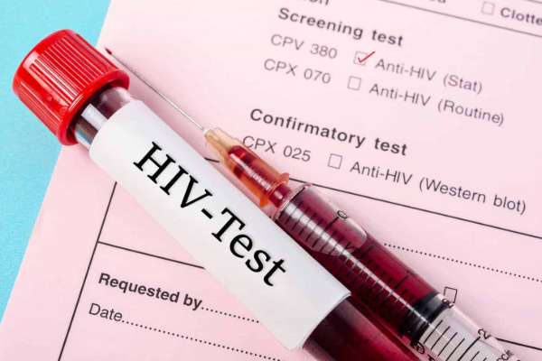 எயிட்ஸ் பரவல் புதிய உச்சம் ; மக்களுக்கு வெளியான எச்சரிக்கை | Hiv Aids Prevalence In Sri Lanka Reaches New Peak எயிட்ஸ் பரவல் புதிய உச்சம் ; மக்களுக்கு வெளியான எச்சரிக்கை | Hiv Aids Prevalence In Sri Lanka Reaches New Peak