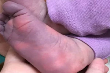 பிரிட்டனிலிருந்து இலங்கைக்கு பரவிய புதிய ஆபத்தான நோய்