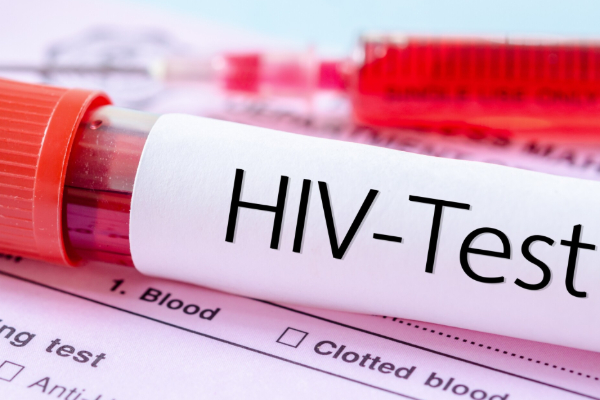 இலங்கையில் இளையோரிடம் அதிகரிக்கும் எயிட்ஸ் தொற்று! | Hiv Increasing Among Young People In Sri Lanka இலங்கையில் இளையோரிடம் அதிகரிக்கும் எயிட்ஸ் தொற்று! | Hiv Increasing Among Young People In Sri Lanka
