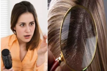 பொடுகு தொல்லைக்கு நிரந்தர தீர்வு வேண்டுமா? அப்போ இந்த வீட்டு வைத்தியம் போதும்