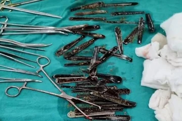 ஸ்பூன்களை விழுங்கிய நபர் - அறுவைச் சிகிச்சையில் அதிர்ந்த மருத்துவர்கள்!