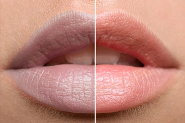 உங்க உதடு ரொம்ப கருப்பா இருக்கா? அப்போ இனி இதை தடவுங்க