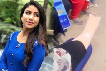 காலில் எழும்பு முறிவு ஏற்பட்டு நடக்க முடியாமல் இருந்த நடிகை ஆல்யா மானசாவா இது?- என்ன குத்தாட்டம் போடுகிறார் பாருங்க