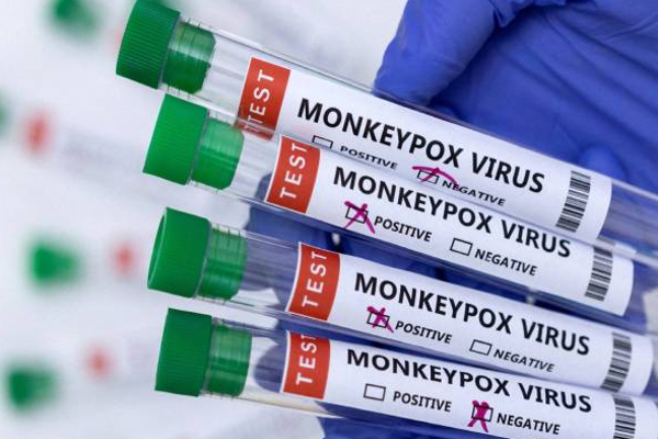 சுவீடனில் குரங்கம்மை நோயுடன் முதலாவது நபர் அடையாளம்! | First Person Identified With Monkeypox In Sweden