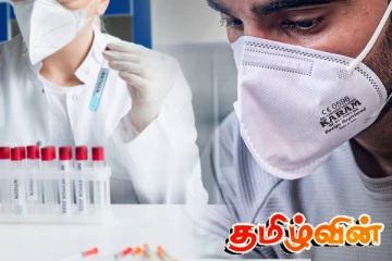 நோய்தொற்று தொடர்பில் பொதுமக்களுக்கு விசேட எச்சரிக்கை
