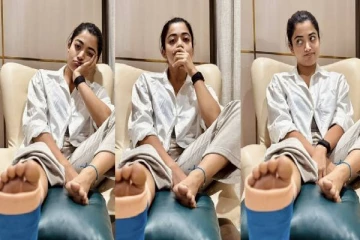 காலில் கட்டுடன் நடிகை ராஷ்மிகா மந்தனா... என்ன நடந்தது தெரியுமா?