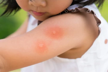 யாழ் சாவகச்சேரியில் 24 குடும்பங்களுக்கு சிவப்பு எச்சரிக்கை