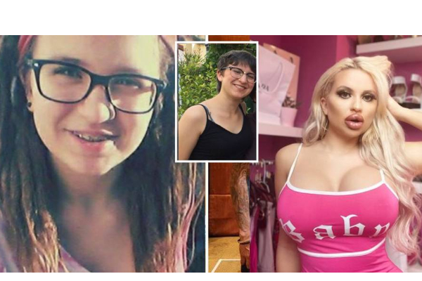 18 வயதில் அழகிற்காக மார்பக அறுவை சிகிச்சை செய்த பெண்! இன்று அவரின் தோற்றம்: வைரலாகும்