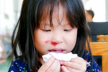 குழந்தையின் மூக்கிலிருந்து திடீரென இரத்தம் வடிய இது தான் காரணமாம்! இனி கவலை வேண்டாம்