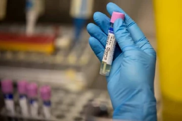 ஐரோப்பாவில் முதல் பலி பதிவானது... ஆப்பிரிக்காவுக்கு வெளியே இது இரண்டாவது