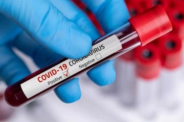 வவுனியாவில் ஏழு கோவிட் - 19 தொற்றாளர்கள் அடையாளம் காணப்பட்டுள்ளனர்!