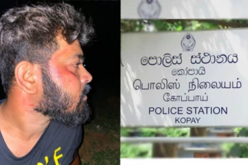 இளைஞரை கடத்தி சென்று சித்திரவதை? ஐந்து பொலிஸாருக்கு இடமாற்றம்