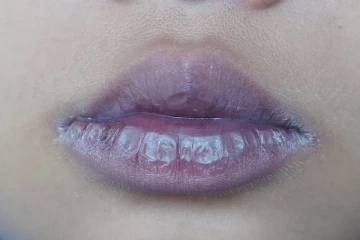 உங்கள் உதடுகள் சாம்பல் நிறத்தில் காணப்படுகின்றனவா? அமெரிக்க மருத்துவர்கள் கூறும் எச்சரிக்கை தகவல்