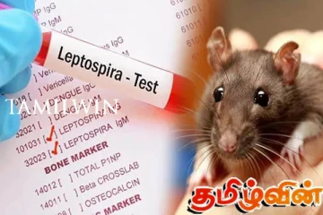 முல்லைத்தீவு புதுக்குடியிருப்பில் எலிக்காய்ச்சலை தடுக்கும் நடவடிக்கைகள் முன்னெடுப்பு