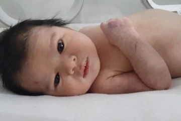 துருக்கி குழந்தை ”அயா” க்காக போட்டிபோடும் மக்கள்; மருத்துவமனையின் மேலாளர் அதிரடி !