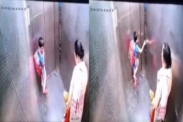 நாயால் சிறுவனுக்கு நேர்ந்த அவலம்; கண்டுக்கொள்ளாத பெண்!