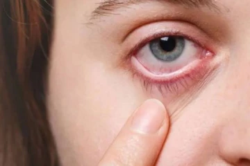 கருப்பு பூஞ்சை ஒருவருக்கு ஏற்பட்டால் கண்டறிவது எப்படி?