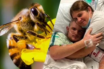 20,000 முறை தேனீக்களால் கொட்டப்பட்ட இளைஞர்; செத்துப்பிழைத்த அதிசயம்!