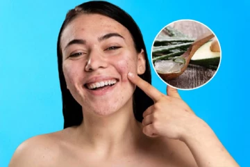 முகப்பரு நீங்க, கரும்புள்ளி மறைய, முகம் அழகு பெற இதை தொடர்ந்து செய்யவும்..!