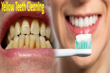 மஞ்சள் பற்களை வெண்மையாக்க வேண்டுமா? பற்பசையில் இதை கலந்தால் போதும்