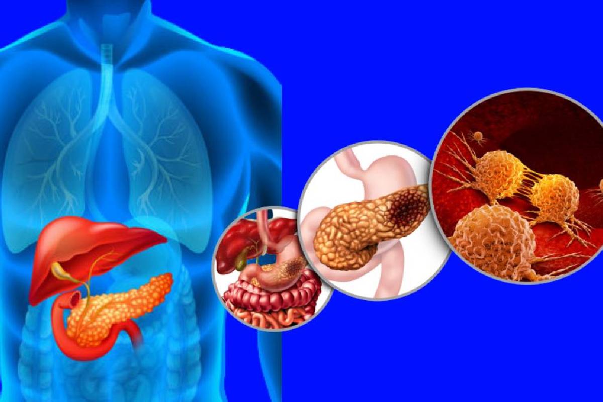 இந்த அறிகுறிகளை புறக்கணிக்காதீர்... புற்றுநோயாக கூட இருக்கலாம் | Cancer Symptoms In Tamil