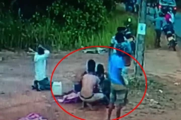 கோர விபத்தில் தனியாக கழன்று சென்ற நபரின் பாதம்