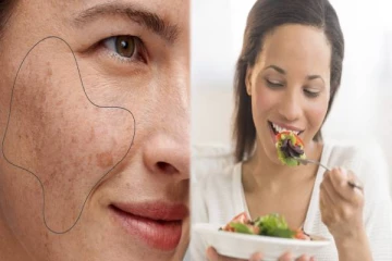 முகத்தில் உள்ள கருத்திட்டுகளை அகற்ற வேண்டுமா? இதை மட்டும் சாப்பிட்டால் போதும்