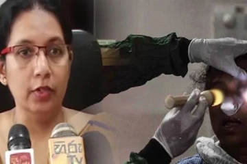 கறுப்பு பூஞ்சைக்கு ஆரம்பத்திலேயே சிகிச்சை அவசியம்; வலியுறுத்தும் விசேட வைத்திய நிபுணர்!