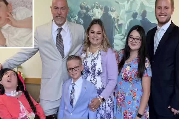 மூளையின் பெரும்பகுதி இல்லை; மருத்துவ உலகின் கணிப்பை பொய்யாக்கிய அமெரிக்க யுவதி! | Us Women Missing Part Brain Celebrate 20 Birthday