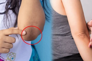 கருப்பாக இருக்கும் முழங்கையை எப்படி இலகுவான முறையில் சிவப்பாக மாற்றலாம்?