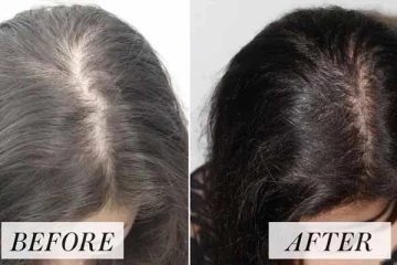 நிரந்தரமாக முடி உதிர்வை நிறுத்தி நீளமாக வளர்க்க உதவும் ஒரு புதிய தீர்வு