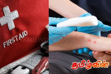 நாட்டில் ஆண்டுதோறும் ஆயிரக்கணக்கானோர் உயிரிழப்பு!வெளியான காரணம்