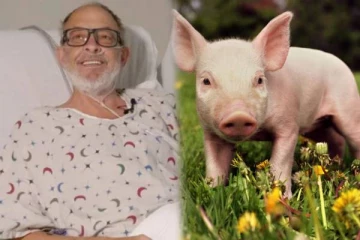 உலகின் 2வது பன்றி இதய மாற்று சிகிச்சை செய்த நபர்.. அடுத்த 40 நாளில் நேர்ந்த சோகம்!