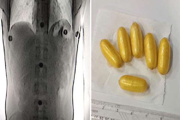 கட்டுநாயக்கவில் தரையிறங்கிய வெளிநாட்டு பிரஜை கைது! | Foreign National Arrested In Katunayake