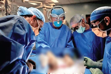 முதல் முறையாக பன்றியின் சிறுநீரகத்தை மனிதனுக்கு பொருத்தி மருத்துவர்கள் சாதனை!