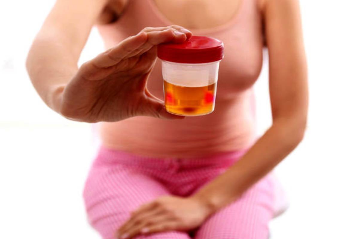 சிறுநீருடன் இரத்தம் வருகிறதா? அப்போ இந்த நோய் இருக்கு... ஜாக்கிரதை | Blood In Urine Sign Of Serious Disease