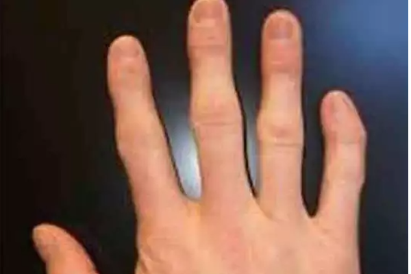 இந்த மாதிரி விரல் இருக்கவங்கள மட்டும் வாழ்நாளில் நம்பாதீர்கள்....ஆபத்தானவர்கள்! | How A Hands And Fingers Tells A Persons Character