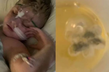 இருமலால் 5 வருடங்கள் அவஸ்தைப்பட்ட சிறுவன்: சோதனையில் மருத்துவர்களுக்கு காத்திருந்த அதிர்ச்சி