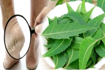 குதிக்கால் வெடிப்புக்கு உடனடி தீர்வு வேண்டுமா? இந்த வீட்டு வைத்தியத்தை ட்ரை பண்ணுங்க ...