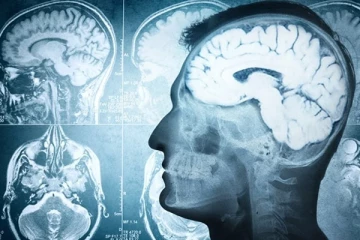 மூளைச்சாவு ஏற்பட இது தான் காரணமாம்! கட்டாயம் தெரிஞ்சிக்கோங்க