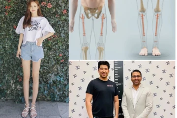 கணவன் உயரம் குறித்து கவலை கொண்ட மனைவி: 3 அங்குலம் வளர 1,30,000 பவுண்டுகள் செலவு செய்த நபர்!