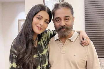 உதட்டில் இரத்த காயத்துடன் கமல் மகள் நடிகை ஸ்ருதி ஹாசன்.. என்ன ஆச்சு மேடம்