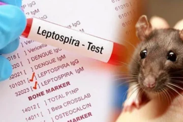 எலிக்காய்ச்சல் பரவலை தடுக்க விசேட நடவடிக்கை