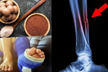 முறிந்த எலும்பும் சீக்கிரம் ஒன்று சேரும் ! பாலை விட மூன்று மடங்கு சத்து நிறைந்த இதையெல்லாம் சாப்பிடுங்க