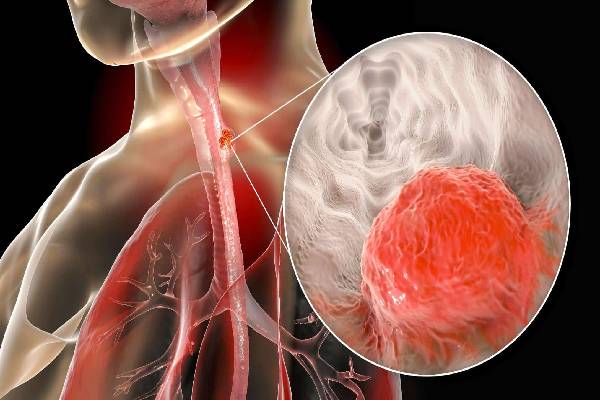 தினமும் ரசம் சாதம் சாப்பிட்டால் இவ்வளவு நன்மைகள் இருக்கா? இப்படி ஒரு செய்து அசத்துங்க | Health Benefits Of Having Rasam And Recipe