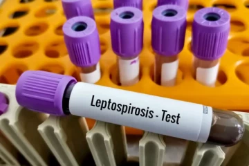 வட இலங்கையில் வேகமாக பரவி வரும் நோய் - அதிகரிக்கும் உயிரிழப்புகள்!