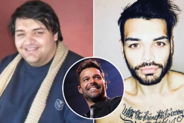 அந்த பாடகரை போல் மாறனும் - 30க்கும் மேற்பட்ட ஆபரேஷன் செய்த இளைஞர்!