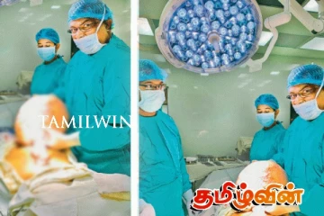 பெண் ஒருவரின் கருப்பையில் இருந்து வெற்றிகரமாக அகற்றப்பட்ட 10 கிலோ எடையுள்ள கட்டி