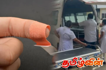 விரலில் காயம் ஏற்பட்டு மருத்துவமனையில் அனுமதிக்கப்பட்ட நபர் பலி